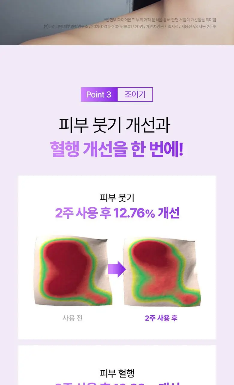 [녹는실|실프팅] 바이오힐보 프로바이오덤 3D 리프팅 바이오톡실 PLGA 세럼 30ml 상세페이지 18